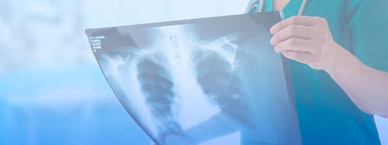 Servicio de Radiografías